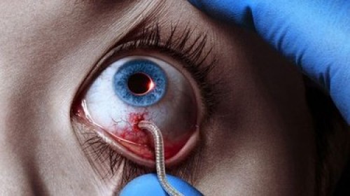 Bệnh Dịch (phần 1) - The Strain (season 1)